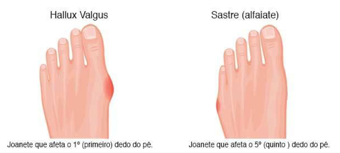 imagem do Google